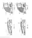 Fig. 04 - Flame prevention device