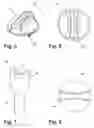 Fig. 04 - Water filter removal and installation tool