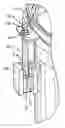 Fig. 01 - Securing drum head to drum body with quick-action drum lug assemblies