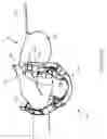 Fig. 02 - Retractable leash assembly