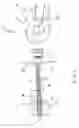 Fig. 02 - MRI Compatible Airway Management Device