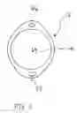 Fig. 03 - MRI Compatible Airway Management Device