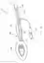Fig. 13 - MRI Compatible Airway Management Device