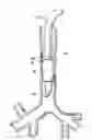 Fig. 01 - Endotracheal cuff and technique for using the same