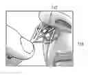 Fig. 01 - NASAL DEVICE APPLICATORS