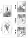 Fig. 09 - NASAL DEVICE APPLICATORS