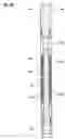 Fig. 35 - Casing expansion and formation compression for permeability plane orientation
