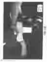 Fig. 82 - Method of vacuum packaging a single use disposable diaper
