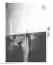 Fig. 83 - PACKAGE HAVING VACUUM PACKED ABSORBENT ARTICLE AND METHODS THEREOF