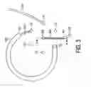 Fig. 05 - Micromachined titanium for high pressure microfluidic applications