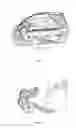 Fig. 02 - Stapler that requires exertion of less effort