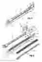 Fig. 06 - Surgical fastener applying apparatus