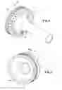 Fig. 04 - Two-piece aft closure for a rocket motor case