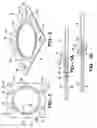 Fig. 02 - MULTI-LAYER GASKET