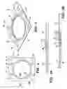 Fig. 03 - MULTI-LAYER GASKET