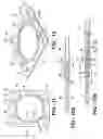 Fig. 07 - MULTI-LAYER GASKET