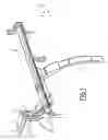 Fig. 02 - Device for Automatically Fixing a Dashboard to a Motor Vehicle Body Shell