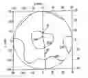 Fig. 01 - Progressive ophthalmic lens and method of producing one such lens