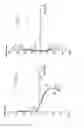 Fig. 06 - Progressive ophthalmic lens and method of producing one such lens