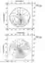 Fig. 07 - Progressive ophthalmic lens and method of producing one such lens