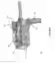 Fig. 06 - Apparatus, system and method for optical spectroscopic measurements