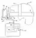 Fig. 01 - Surgical headlamp