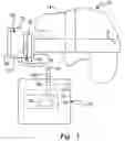 Fig. 02 - Surgical headlamp