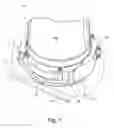 Fig. 02 - Method and apparatus for repairing a jet pump diffuser adapter to tailpipe weld