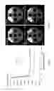 Fig. 06 - Fast self-calibrating radial sensitivity encoded image reconstruction using rescaling and preconditioning