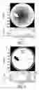 Fig. 03 - Apparatus and Method for the Processing of Sectional Images