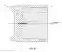 Fig. 09 - Measuring Linear Separations in Digital Radiographs