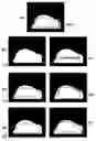 Fig. 01 - Method and apparatus of using probabilistic atlas for feature removal/positioning