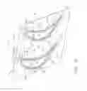 Fig. 06 - Airfoil leading edge end wall vortex reducing plasma