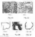Fig. 14 - Method and pharmaceutical composition for treating inflammation