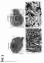 Fig. 07 - Bone graft comprising a demineralized bone matrix and a stabilizing agent