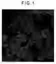 Fig. 02 - Microparticle preparation and medical composition