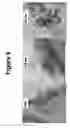 Fig. 07 - Hollow silica nanoparticles as well as synthesis processes and applications thereof