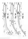 Fig. 02 - Yankauer suction device with sleeve and wiper