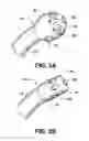 Fig. 03 - Yankauer suction device with sleeve and wiper
