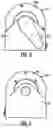 Fig. 04 - Organ transportation device
