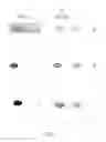 Fig. 02 - Method and Nucleic Acids For the Differentiation of Astrocytoma, Oligoastrocytoma and Oligodenroglioma Tumor Cells