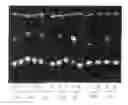 Fig. 01 - Methods for identifying lysophosphatidylcholine acyltransferases