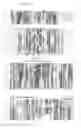 Fig. 04 - Methods for identifying lysophosphatidylcholine acyltransferases