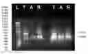 Fig. 01 - Stabilized compositions of thermostable DNA polymerase and anionic or zwitterionic detergent