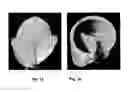 Fig. 02 - Method of manufacturing a tissue-engineered prosthesis