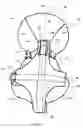 Fig. 06 - Personal flotation device for infants