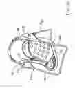 Fig. 11 - Motor Control Voltage Calibration for a Child Motion Device