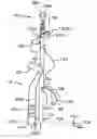 Fig. 01 - Portable golf caddy