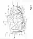 Fig. 03 - Golf putter head