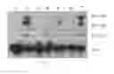 Fig. 02 - Compounds and methods for treating estrogen receptor-related diseases